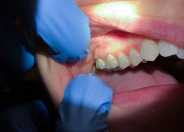 Best Pediatric Emergency Dentist in Grafton, ND